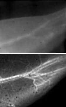 Image: These images of a mouse's blood vessels show the difference in resolution between traditional near-infrared fluorescence imaging (top) and Stanford's new NIR-2 technique (bottom) (Photo courtesy of Stanford University). Image: These images of a mouse's blood vessels show the difference in resolution between traditional near-infrared fluorescence imaging (top) and Stanford's new NIR-2 technique (bottom) (Photo courtesy of Stanford University).